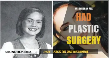 Megan Fox's Transformation: Plastic Surgery Rumors and Reality Revealed