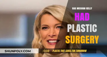 Meghan Kelly's Transformation: Plastic Surgery Speculations and Truths