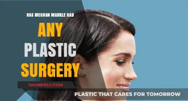 Meghan Markle's Transformation: Plastic Surgery Speculations and Facts Revealed