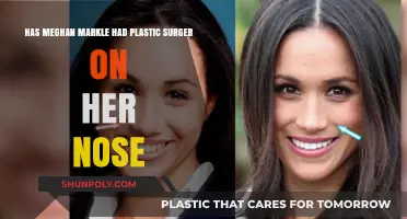 Exploring the Rumors: Has Meghan Markle Had a Nose Job?