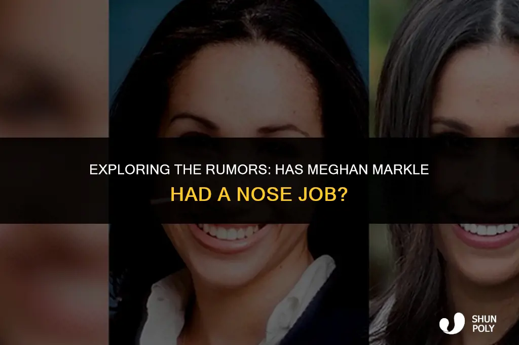 has meghan markle had plastic surger on her nose