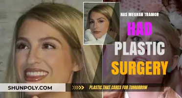 Meghan Trainor's Transformation: Plastic Surgery Rumors and Reality Revealed