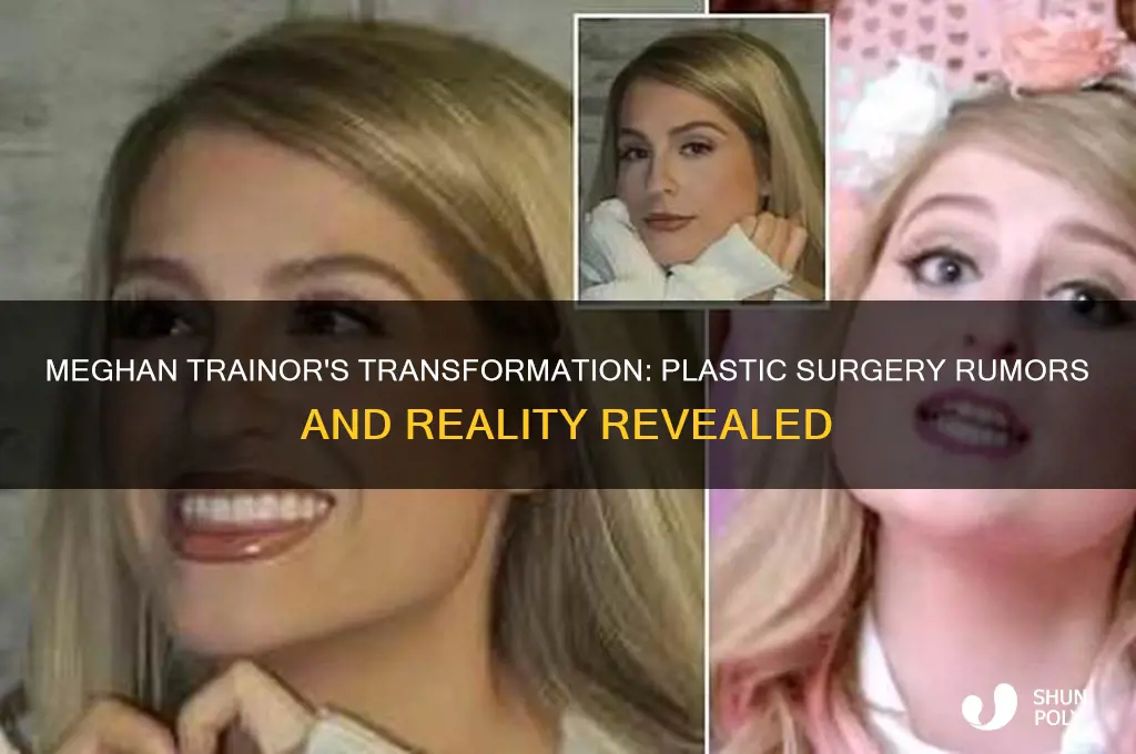 has meghan trainor had plastic surgery