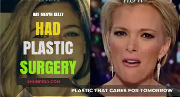 Megyn Kelly's Transformation: Plastic Surgery Speculations and Truths Revealed