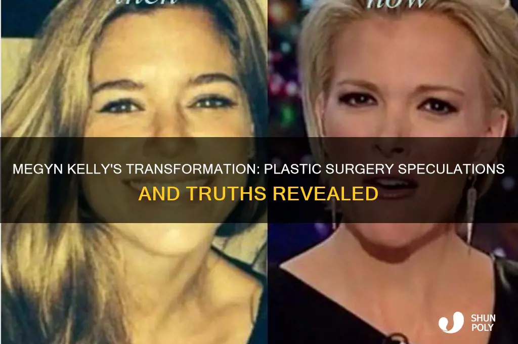has megyn kelly had plastic surgery