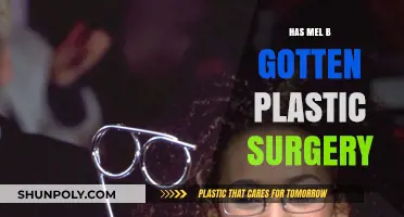 Mel B's Transformation: Plastic Surgery Rumors and Reality Revealed