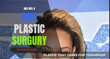 Mel B's Plastic Surgery: What's True and What's Not?