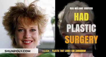 Melanie Griffith's Transformation: Plastic Surgery Speculations and Truths