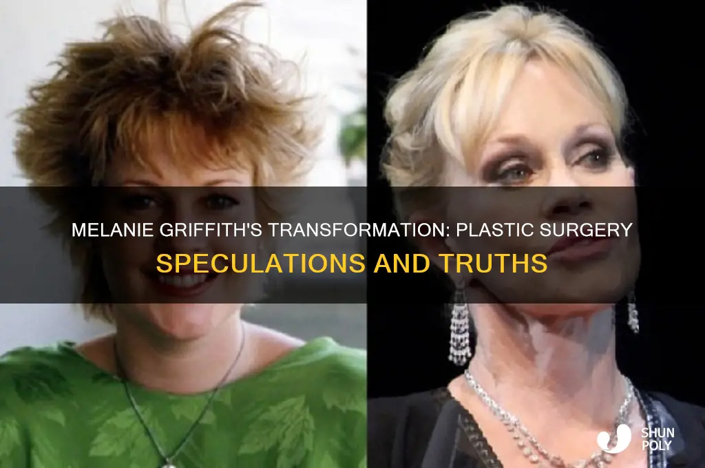 has melanie griffith had plastic surgery