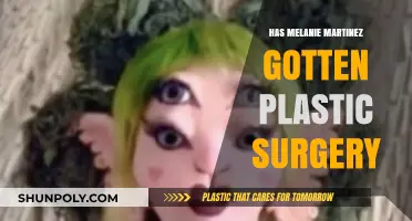 Melanie Martinez Plastic Surgery: Fact-Checking the Rumors and Speculations