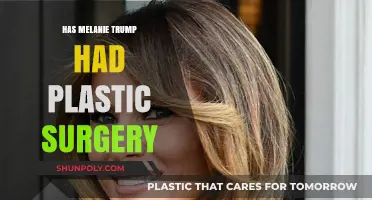 Melania Trump's Transformation: Unveiling the Plastic Surgery Speculations