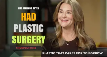 Melinda Gates Plastic Surgery: Fact-Checking the Rumors and Speculations