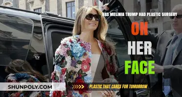 Maligna Trump's Facial Transformation: Plastic Surgery Speculations and Facts