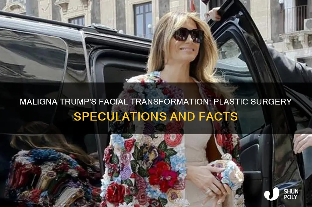 has melinia trump had plastic surgery on her face