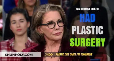 Melissa Gilbert's Transformation: Plastic Surgery Rumors and Speculations