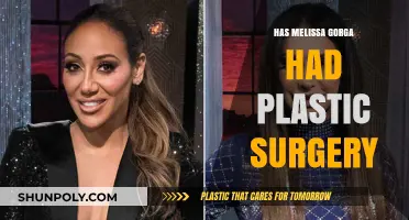 Melissa Gorga's Transformation: Plastic Surgery Rumors Explored