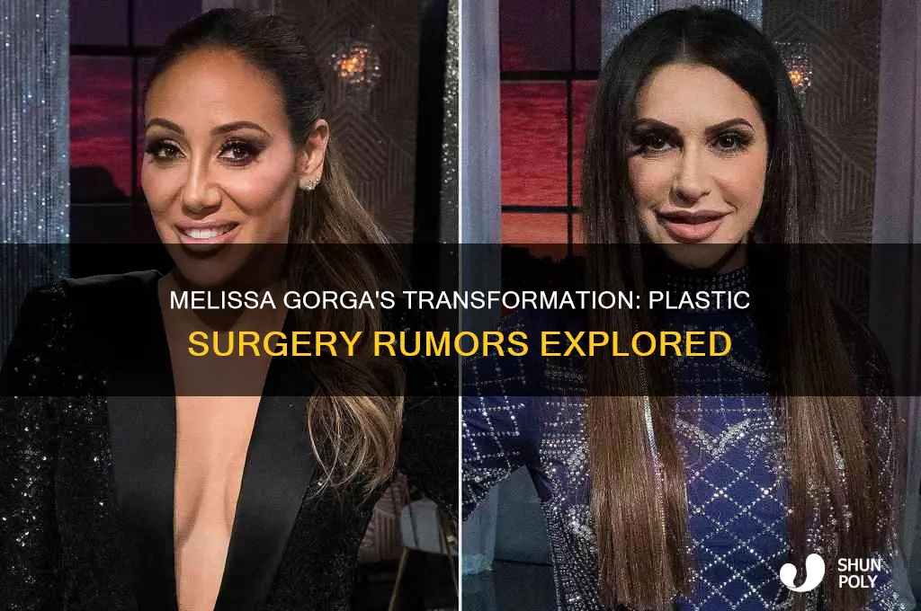 has melissa gorga had plastic surgery
