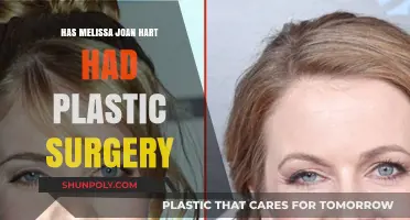 Melissa Joan Hart's Transformation: Plastic Surgery Rumors Explored