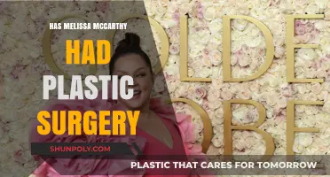 Melissa McCarthy's Transformation: Plastic Surgery Rumors Explored