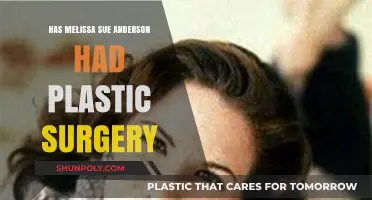 Melissa Sue Anderson's Transformation: Plastic Surgery Speculations Explored