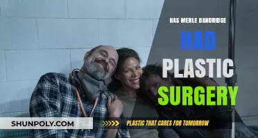 Merle Dandridge Plastic Surgery: Fact-Checking the Rumors and Speculations