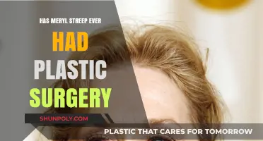 Meryl Streep's Ageless Beauty: Plastic Surgery Rumors Explored