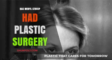 Meryl Streep's Ageless Beauty: Plastic Surgery Speculations Explored