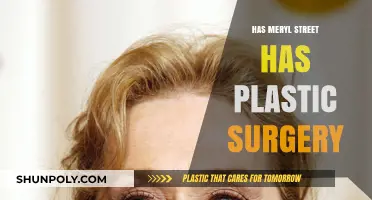 Meryl Streep Plastic Surgery: Fact-Checking the Rumors and Speculations