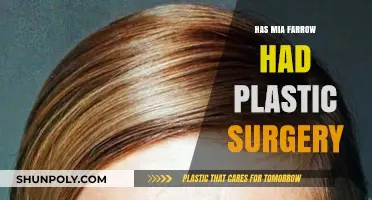 Mia Farrow's Transformation: Plastic Surgery Rumors and Reality Revealed