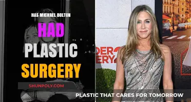 Michael Bolton's Transformation: Plastic Surgery Speculations and Truths