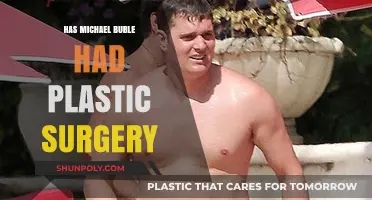 Michael Bublé's Transformation: Plastic Surgery Rumors Explored and Debunked