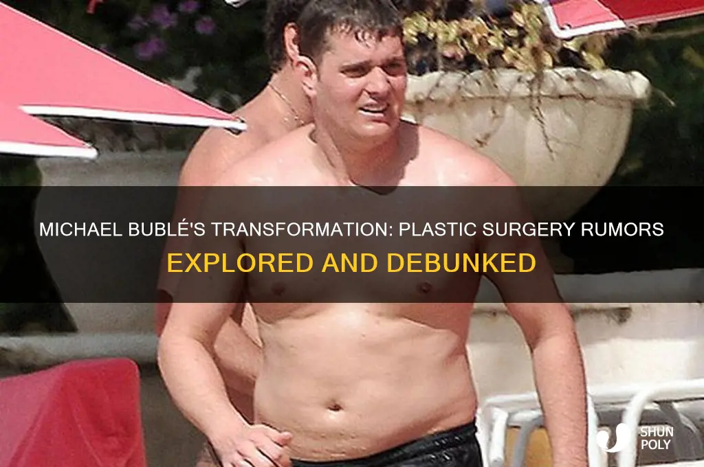 has michael buble had plastic surgery