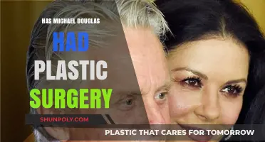 Michael Douglas Plastic Surgery: Fact-Checking the Rumors and Speculations