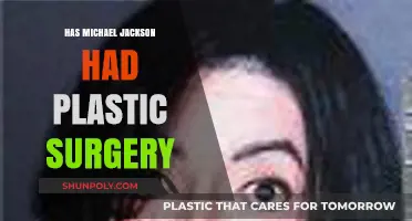 Michael Jackson's Transformation: Unveiling the Truth About Plastic Surgery