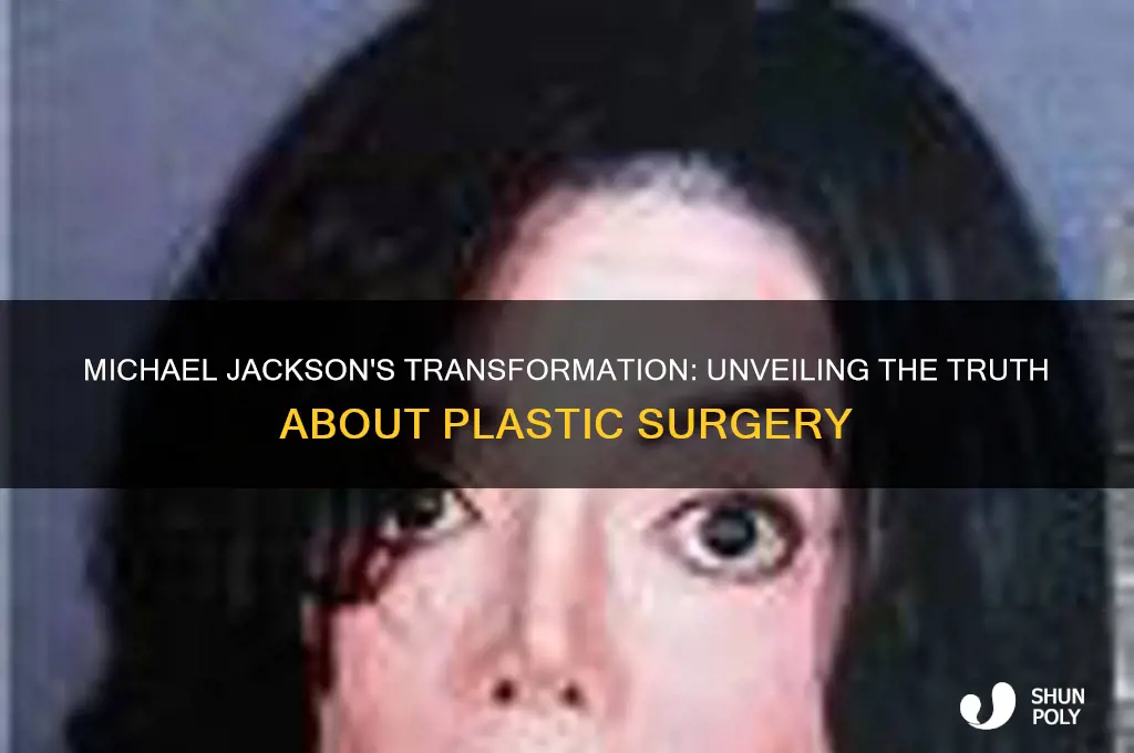 has michael jackson had plastic surgery