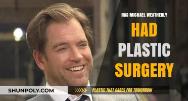 Michael Weatherly's Transformation: Plastic Surgery Rumors Explored