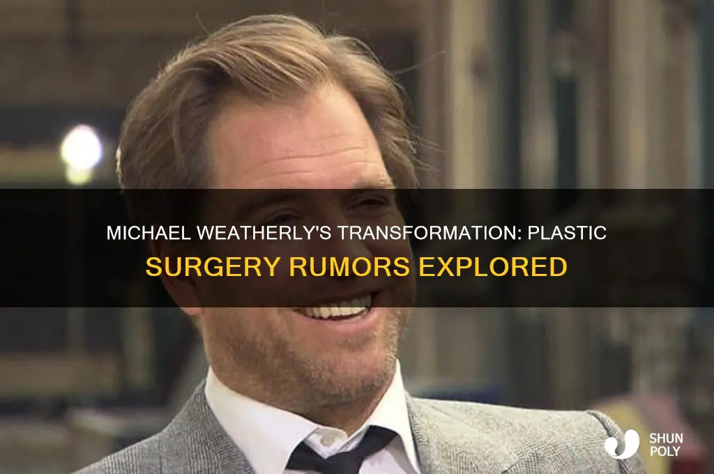 has michael weatherly had plastic surgery