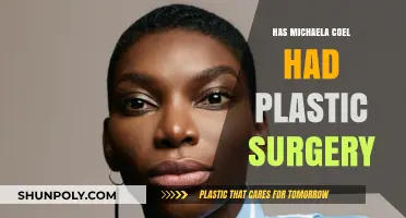 Michaela Coel's Transformation: Plastic Surgery Rumors Explored and Debunked