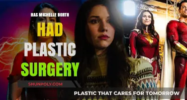 Michelle Borth's Transformation: Plastic Surgery Speculations and Truths