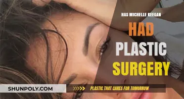 Michelle Keegan's Transformation: Plastic Surgery Rumors Explored