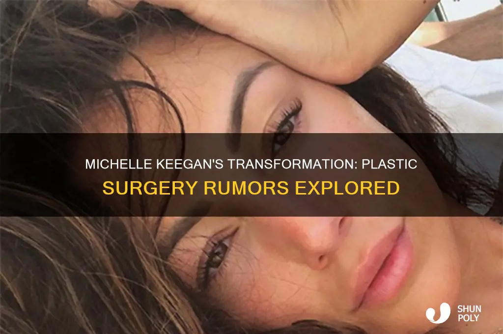 has michelle keegan had plastic surgery