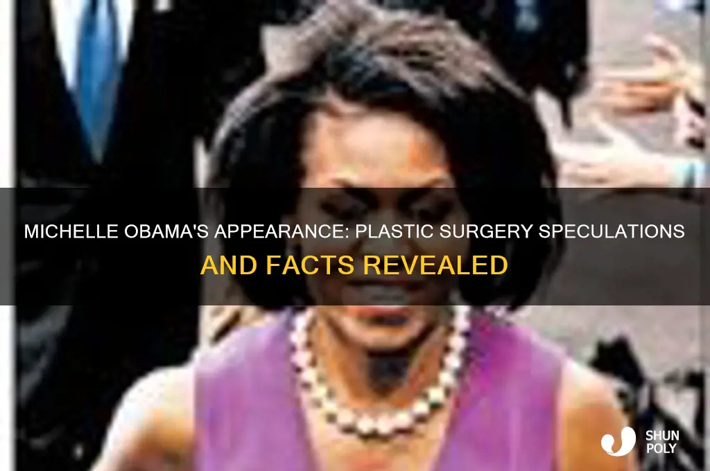 has michelle obama had plastic surgery