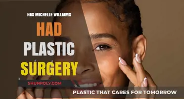 Michelle Williams Plastic Surgery: Fact-Checking the Transformation Rumors