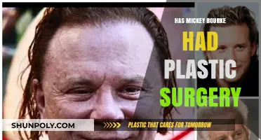 Mickey Rourke's Transformation: Plastic Surgery Rumors Explored