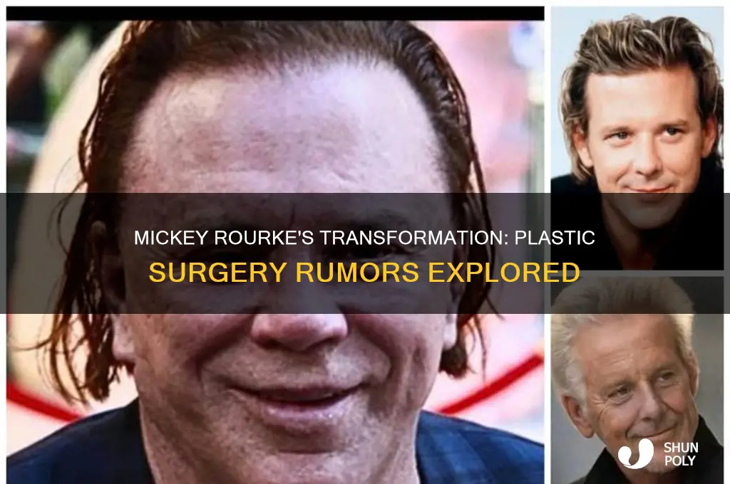 has mickey rourke had plastic surgery