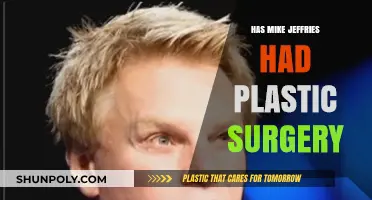 Mike Jeffries Plastic Surgery: Fact-Checking the Abercrombie CEO's Transformation