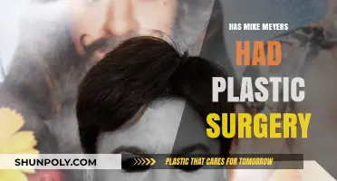Mike Meyers' Appearance: Plastic Surgery Rumors Explored and Debated