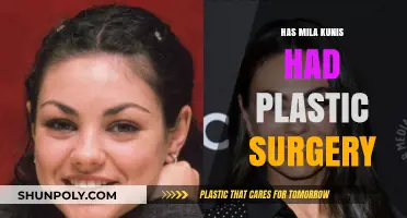 Mila Kunis Plastic Surgery: Fact-Checking the Transformation Rumors