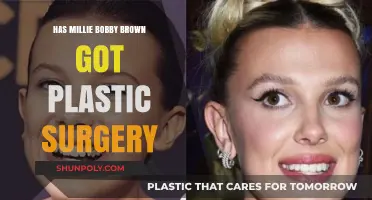 Millie Bobby Brown Plastic Surgery Rumors: Fact or Fiction?