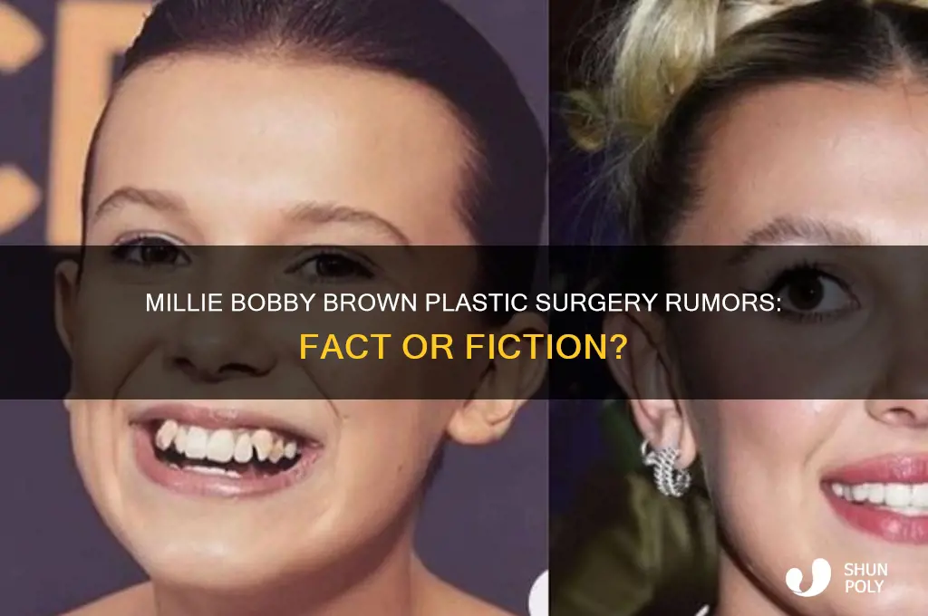 has millie bobby brown got plastic surgery